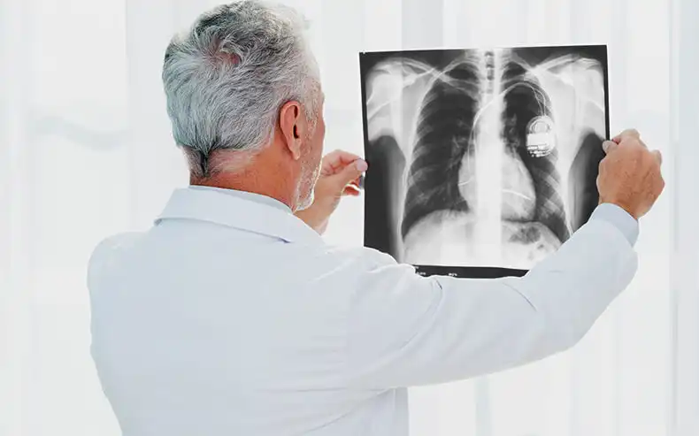 МРТ позвоночника и суставов VS рентгенография позвоночника и суставов
